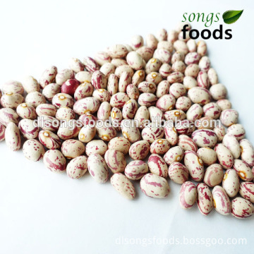 Different Types of Pulses, Kidney Agents